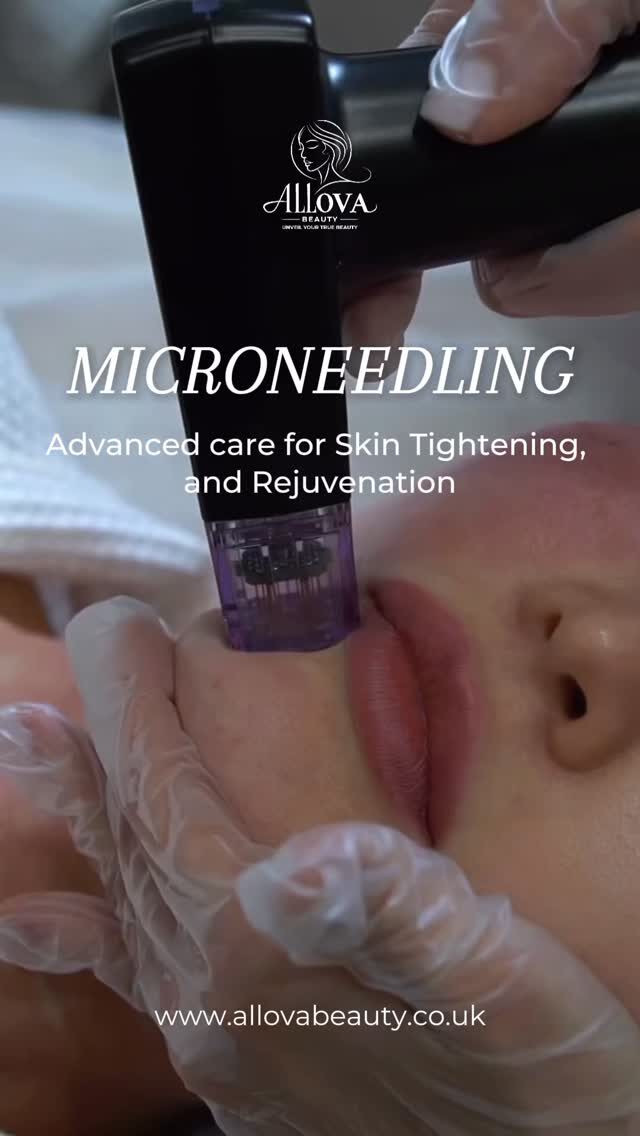 Instagram post from allovabeauty_official. This post is in position 11.